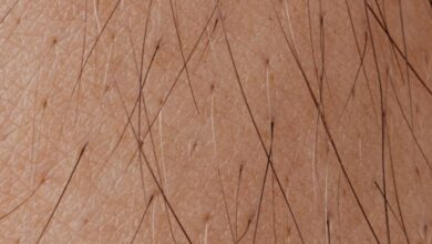 Hair Growth Treatments - Detailed macro image showing human skin texture and hair follicles.