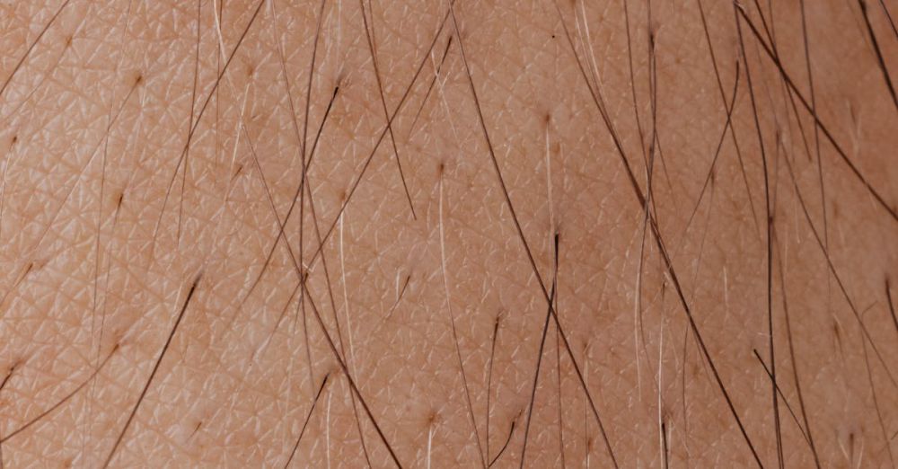 Hair Growth Treatments - Detailed macro image showing human skin texture and hair follicles.