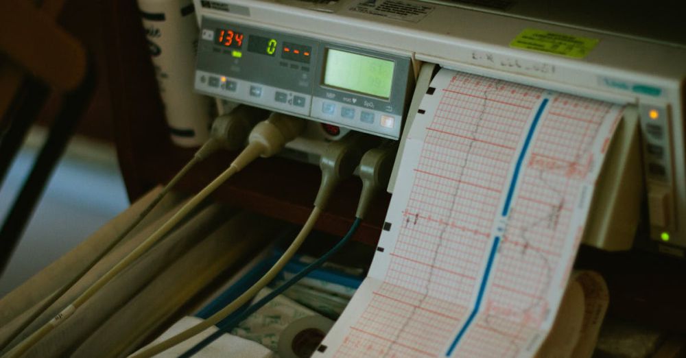 Heart Rate Monitors - Close-up of an ECG machine displaying heart rate results in a hospital setting.