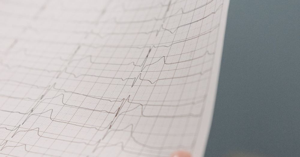 ECG Monitors - A detailed view of a person holding an electrocardiogram printout in a soft focus setting.