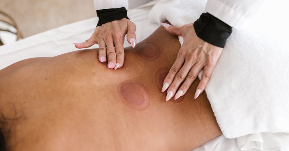 Scar Treatments - Close-up of a therapist performing cupping therapy on a back, promoting wellness.