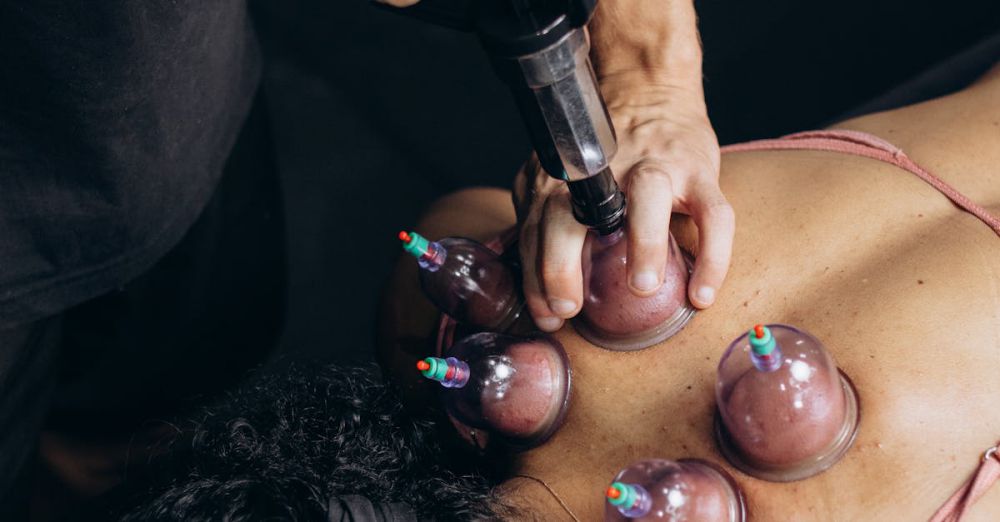 Massage Spas - A person receives cupping therapy on their back to promote muscle recovery and relaxation.