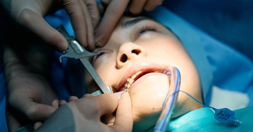 Facial Scrubs - Intricate dental surgery procedure with multiple hands in a hospital setting.