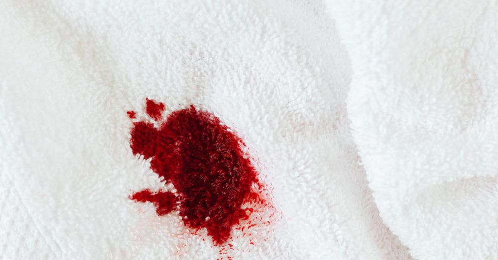 Stain Removers - A close-up view of a red stain on a white towel, highlighting laundry challenges.